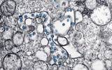 This 2020 electron microscope image made available by the US Centers for Disease Control and Prevention shows the spherical particles of the new coronavirus, colorized blue, from the first US case of COVID-19. (Hannah A. Bullock, Azaibi Tamin/CDC via AP)