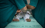 Illustrative: Doctors treat a baby at the Wolfson Medical Center in Holon, Israel, on August 13, 2018. ( Hadas Parush/Flash90 )