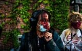 A journalist is seen bleeding after police started firing tear gas and rubber bullets near the 5th police precinct following a demonstration to call for justice for George Floyd, a black man who died while in custody of the Minneapolis police, on May 30, 2020 in Minneapolis, Minnesota (CHANDAN KHANNA / AFP)