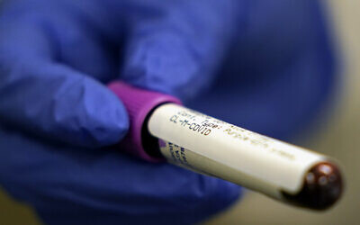 A lab assistant holds a blood sample to be tested for COVID-19 antibodies, April 28, 2020, in Houston, Texas. (AP Photo/David J. Phillip)