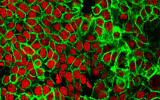 This microscope image made available by the National Cancer Institute Center for Cancer Research in 2015 shows human colon cancer cells with the nuclei stained red. (NCI Center for Cancer Research via AP)