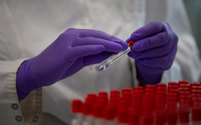 Illustrative: A lab technician puts a label on to a test tube while conducting research on coronavirus in Beerse, Belgium, June 17, 2020. (AP Photo/Virginia Mayo) Illustrative: A lab technician puts a label on to a test tube while conducting research on coronavirus in Beerse, Belgium, June 17, 2020. (AP Photo/Virginia Mayo)