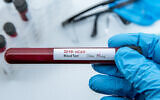 A negative coronavirus blood sample test (iStock)