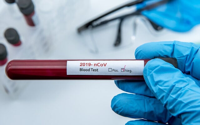 A negative coronavirus blood sample test (iStock) A negative coronavirus blood sample test (iStock)