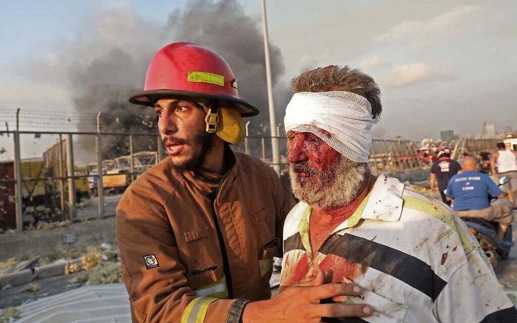 A wounded man is helped by a fireman near the scene of an explosion in Beirut on August 4, 2020. (ANWAR AMRO / AFP)