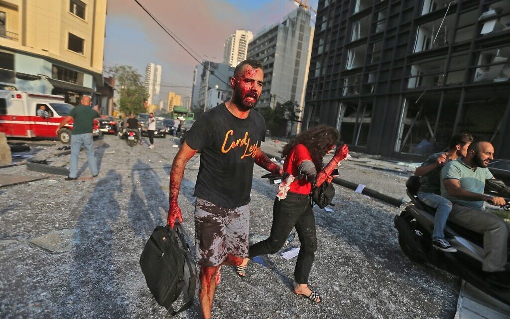 Wounded people walk near the site of an explosion at the port in the Lebanese capital Beirut on August 4, 2020 (STR / AFP)
