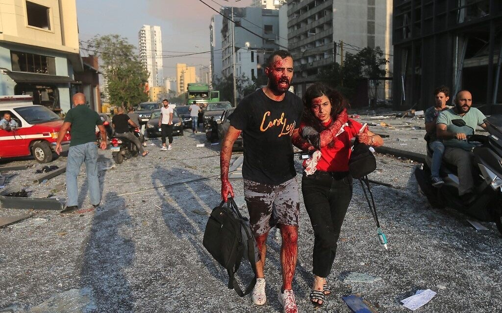 Wounded people walk near the site of an explosion at the port in the Lebanese capital Beirut on August 4, 2020 (STR / AFP) Wounded people walk near the site of an explosion at the port in the Lebanese capital Beirut on August 4, 2020 (STR / AFP)