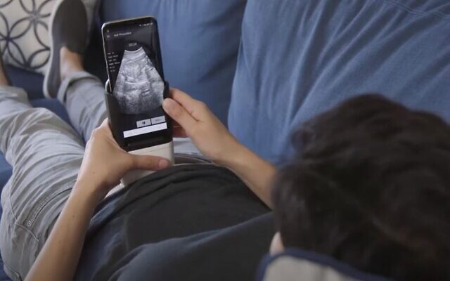 The hand-held ultrasound developed by PulseNmore, allows women to monitor the wellbeing of the fetus at home (YouTube screenshot) The hand-held ultrasound developed by PulseNmore, allows women to monitor the wellbeing of the fetus at home (YouTube screenshot)