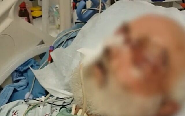 Avi Ben Shahar, in undated video footage, after he was attacked by his cellmate. (Screen grab/Channel 12 news) Avi Ben Shahar, in undated video footage, after he was attacked by his cellmate. (Screen grab/Channel 12 news)