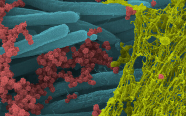 An image produced by US researchers shows SARS-CoV-2 virus particles (red), covering human bronchial cilia (blue), and mucus (yellow). (Ehre Lab, UNC School of Medicine) An image produced by US researchers shows SARS-CoV-2 virus particles (red), covering human bronchial cilia (blue), and mucus (yellow). (Ehre Lab, UNC School of Medicine)