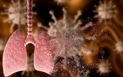 Illustrative image: 3D rendering of the coronavirus attacking a lung with severe pneumonia (iStock)