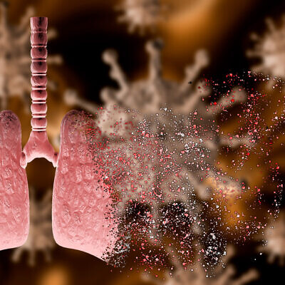 Illustrative image: 3D rendering of the coronavirus attacking a lung with severe pneumonia (iStock)