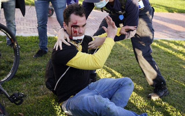 A counter-protester helps a supporter of US President Donald Trump who was injured after he was attacked during a pro-Trump rally, Nov. 14, 2020, in Washington. (AP Photo/Jacquelyn Martin) A counter-protester helps a supporter of US President Donald Trump who was injured after he was attacked during a pro-Trump rally, Nov. 14, 2020, in Washington. (AP Photo/Jacquelyn Martin)