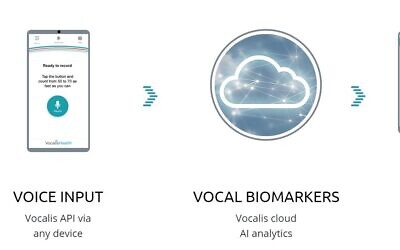 An illustration of the software developed by Vocalis Health, to identify vocal biomarkers to detect illnesses (Courtesy)