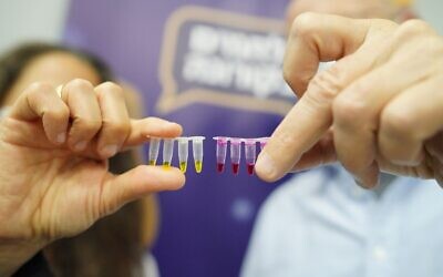 Samples from the NaorCov19 test, developed by the Technion-Israel Institute of Technology. Red indicates a positive result; yellow is negative. (courtesy of the Technion-Israel Institute of Technology)