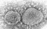 Electron microscope image shows SARS-CoV-2 virus particles which cause COVID-19. (Hannah A. Bullock, Azaibi Tamin/CDC via AP)