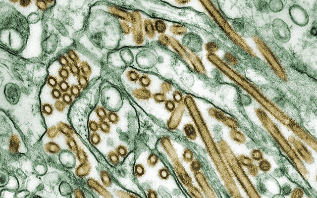 Illustrative: Colorized transmission electron micrograph of Avian influenza A H5N1 viruses (seen in gold) grown in MDCK cells (seen in green). (Cynthia Goldsmith Content Providers: CDC / Wikipedia) Illustrative: Colorized transmission electron micrograph of Avian influenza A H5N1 viruses (seen in gold) grown in MDCK cells (seen in green). (Cynthia Goldsmith Content Providers: CDC / Wikipedia)