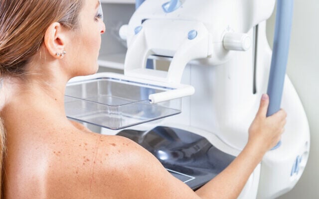 A woman undergoing a medical mammography scan. (jovannig via iStock by Getty Images) A woman undergoing a medical mammography scan. (jovannig via iStock by Getty Images)