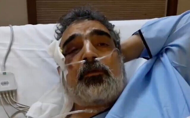 Behrouz Kamalvandi, spokesman for the Atomic Energy Organization of Iran, is interviewed from his hospital bed on April 12, 2021, after being injured the day before in a reported fall at the Natanz nuclear facility. (Screen capture: Twitter) Behrouz Kamalvandi, spokesman for the Atomic Energy Organization of Iran, is interviewed from his hospital bed on April 12, 2021, after being injured the day before in a reported fall at the Natanz nuclear facility. (Screen capture: Twitter)