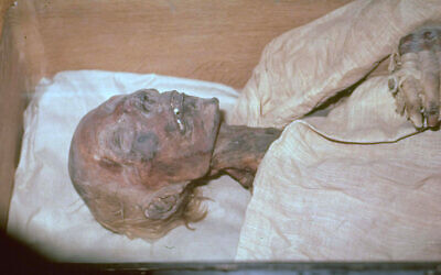 The remains of the Egyptian pharaoh Ramses II, in Paris, October 28, 1976. (AP Photo/Files)