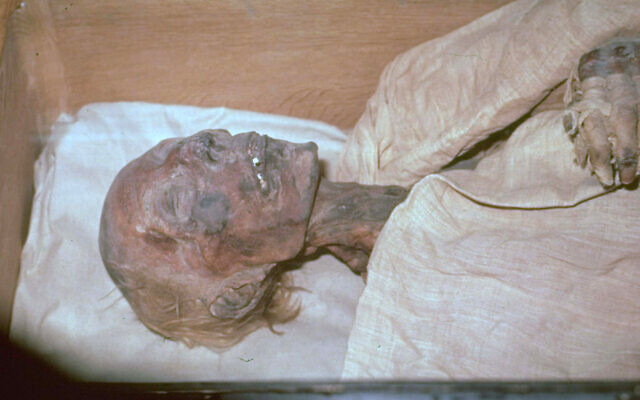 The remains of the Egyptian pharaoh Ramses II, in Paris, October 28, 1976. (AP Photo/Files)
