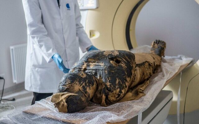 The pregnant Egyptian mummy is prepared for X-ray scans at a medical centre in Otwock near Warsaw, Poland in December 2015. (Warsaw Mummy Project) The pregnant Egyptian mummy is prepared for X-ray scans at a medical centre in Otwock near Warsaw, Poland in December 2015. (Warsaw Mummy Project)