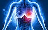 A 3D illustration of breast cancer (Mohammed Haneefa Nizamudeen via iStock by Getty Images)