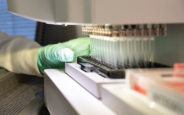In this 2019 photo provided by Biogen, a researcher works on the development of the medication aducanumab in Cambridge, Mass. On Monday, June 7, 2021, the Food and Drug Administration approved aducanumab, the first new drug for Alzheimer’s disease in nearly 20 years, disregarding warnings from independent advisers that the much-debated treatment hasn’t been shown to help slow the brain-destroying disease. (Biogen via AP) In this 2019 photo provided by Biogen, a researcher works on the development of the medication aducanumab in Cambridge, Mass. On Monday, June 7, 2021, the Food and Drug Administration approved aducanumab, the first new drug for Alzheimer’s disease in nearly 20 years, disregarding warnings from independent advisers that the much-debated treatment hasn’t been shown to help slow the brain-destroying disease. (Biogen via AP)