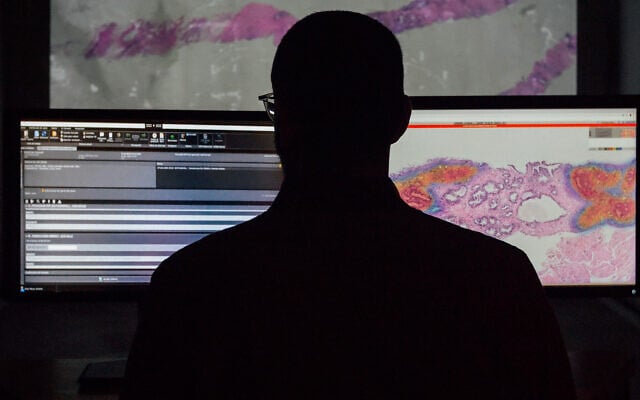 The AI-based software developed by Ibex Medical Analytics, in use at Unilabs. (Courtesy)