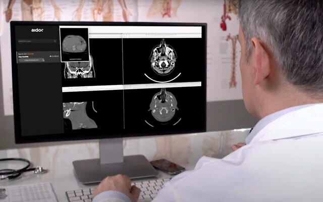 Aidoc's AI-based technology helps radiologists read scans (Guy Schreiber)
