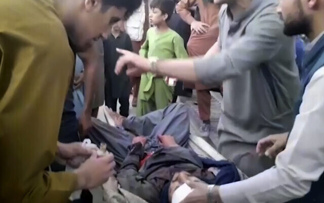 In this frame grab from video, people attend to a wounded man near the site of a deadly explosion outside the airport in Kabul, Afghanistan, August 26, 2021. (AP Photo) In this frame grab from video, people attend to a wounded man near the site of a deadly explosion outside the airport in Kabul, Afghanistan, August 26, 2021. (AP Photo)