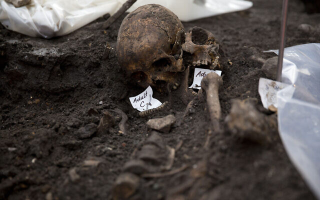 Illustrative: Two adult skulls lie next to each other at an archaeological excavation site in London, March 6, 2015. (AP/Matt Dunham) Illustrative: Two adult skulls lie next to each other at an archaeological excavation site in London, March 6, 2015. (AP/Matt Dunham)