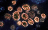 This 2020 electron microscope image provided by the National Institute of Allergy and Infectious Diseases - Rocky Mountain Laboratories shows SARS-CoV-2 virus particles which cause COVID-19, isolated from a patient in the U.S., emerging from the surface of cells cultured in a lab. According to a study released in The Lancet Global Health on Wednesday, Oct. 27, 2021, Fluvoxamine, a cheap antidepressant, reduced the need for hospitalization among high-risk adults with COVID-19. (NIAID-RML via AP)