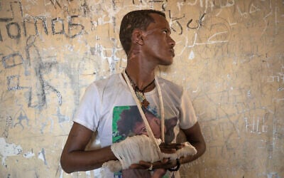 FILE - Ethnic Tigrayan survivor Abrahaley Minasbo, 22, from Mai-Kadra, Ethiopia, shows wounds from machetes he says were inflicted by a pro-government militia on Nov. 9, inside a shelter in Hamdeyat Transition Center near the Sudan-Ethiopia border, in eastern Sudan on Dec. 15, 2020 (AP Photo/Nariman El-Mofty, File)