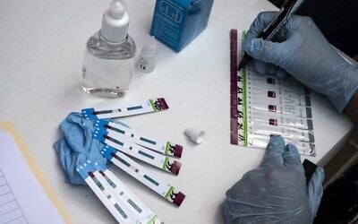 A health worker verifies the process of rapid HIV/AIDS tests taken from passersby at Morelos Square in Caracas, Venezuela, on December 3, 2021. (Yuri CORTEZ / AFP)