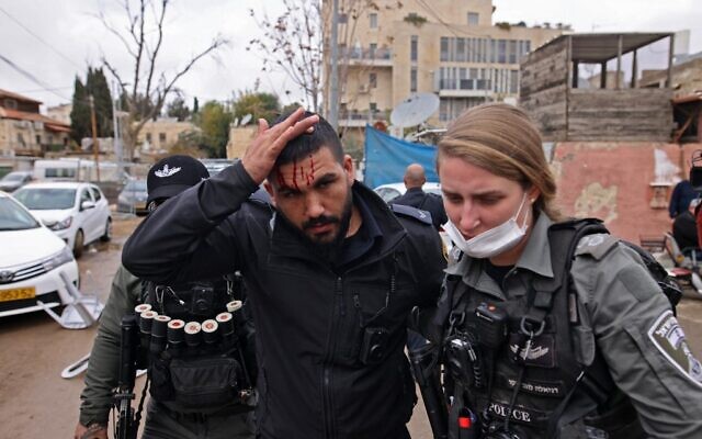 A member of the Israeli security forces reacts after being injured during an altercation with Palestinian protesters during a demonstration in the East Jerusalem neighborhood of Sheikh Jarrah, on December 17, 2021. (AHMAD GHARABLI/AFP) A member of the Israeli security forces reacts after being injured during an altercation with Palestinian protesters during a demonstration in the East Jerusalem neighborhood of Sheikh Jarrah, on December 17, 2021. (AHMAD GHARABLI/AFP)