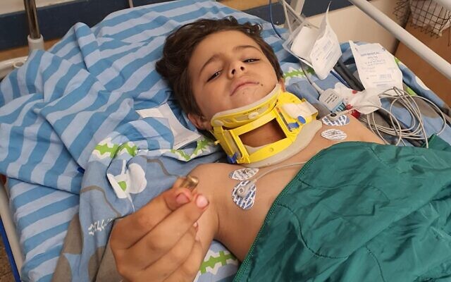 Yousef Sammir Alafenish shows the bullet that struck his neck, from a hospital bed at the Soroka Medical Center in Beersheba. (Courtesy) Yousef Sammir Alafenish shows the bullet that struck his neck, from a hospital bed at the Soroka Medical Center in Beersheba. (Courtesy)