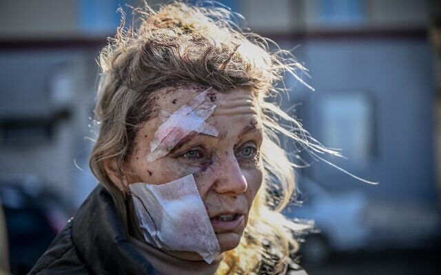 Olena Kurilo stands outside a hospital after the bombing of the eastern Ukraine town of Chuguiv, on February 24, 2022, as Russian armed forces attempt to invade Ukraine from several directions, using rocket systems and helicopters to attack Ukrainian position in the south, the border guard service said. (Aris Messinis/AFP) Olena Kurilo stands outside a hospital after the bombing of the eastern Ukraine town of Chuguiv, on February 24, 2022, as Russian armed forces attempt to invade Ukraine from several directions, using rocket systems and helicopters to attack Ukrainian position in the south, the border guard service said. (Aris Messinis/AFP)