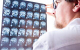 Illustrative image: A doctor evaluates results of magnetic resonance imaging of a brain. (iStock via Getty Images)