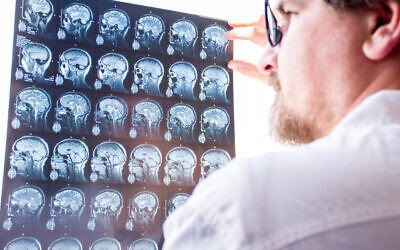 Illustrative image: A doctor evaluates results of magnetic resonance imaging of a brain. (iStock via Getty Images)