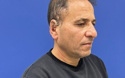 A patient who received reconstructive surgery of the ear at Shaare Zedek Medical Center in Jerusalem. (Courtesy)