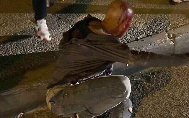 An Israeli man attacked after entering the East Jerusalem neighborhood of Issawiyah on May 15, 2022 (Twitter) An Israeli man attacked after entering the East Jerusalem neighborhood of Issawiyah on May 15, 2022 (Twitter)