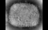 This 2003 electron microscope image made available by the Centers for Disease Control and Prevention shows a monkeypox virion, obtained from a sample associated with a 2003 outbreak. (Cynthia S. Goldsmith, Russell Regner/CDC via AP)