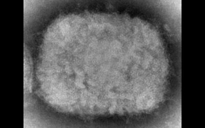 This 2003 electron microscope image made available by the Centers for Disease Control and Prevention shows a monkeypox virion, obtained from a sample associated with a 2003 outbreak. (Cynthia S. Goldsmith, Russell Regner/CDC via AP)