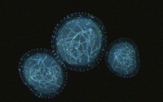 Illustrative: Monkeypox virus (Udomkarn Chitkul/iStock by Getty Images)