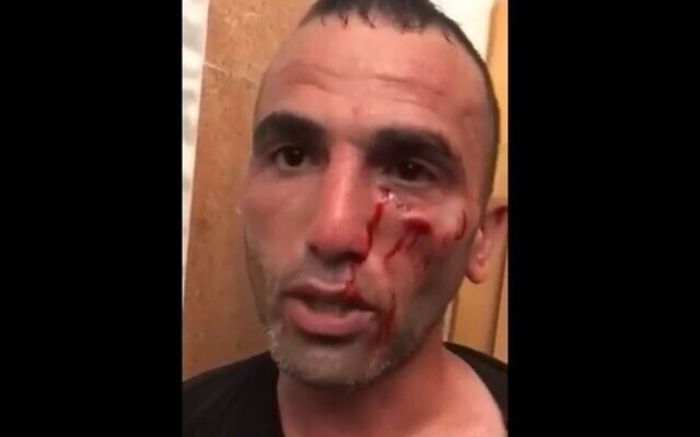 A Palestinian man who was reportedly beaten by other Palestinians at Al-Aqsa Mosque on May 29, 2022, for allegedly sending information to Israeli authorities on developments there (Walla screenshot; used in accordance with Clause 27a of the copyright law) A Palestinian man who was reportedly beaten by other Palestinians at Al-Aqsa Mosque on May 29, 2022, for allegedly sending information to Israeli authorities on developments there (Walla screenshot; used in accordance with Clause 27a of the copyright law)