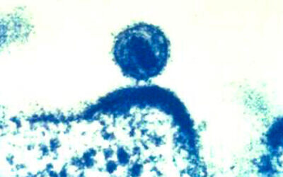 A single human immunodeficiency (HIV) virus buds from a human immune cell, which the virus had infected, and within which the HIV virus had been replicated. (NIAID via AP)