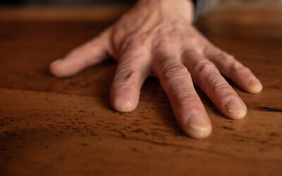 Illustrative: An amputated hand on a wooden table. (BW Studio; iStock by Getty Images)