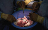 In this photo provided by NYU Langone Health, surgeons prepare a genetically modified pig heart for transplant into a recently deceased donor at NYU Langone Health on July 6, 2022, in New York (Joe Carrotta/NYU Langone Health via AP)
