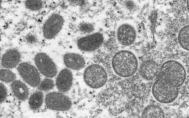This 2003 electron microscope image made available by the Centers for Disease Control and Prevention shows mature, oval-shaped monkeypox virions, left, and spherical immature virions, right, obtained from a sample of human skin (Cynthia S. Goldsmith, Russell Regner/CDC via AP, File) This 2003 electron microscope image made available by the Centers for Disease Control and Prevention shows mature, oval-shaped monkeypox virions, left, and spherical immature virions, right, obtained from a sample of human skin (Cynthia S. Goldsmith, Russell Regner/CDC via AP, File)